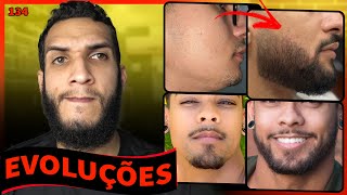 EVOLUÇÕES COM MINOXIDIL  RESULTADOS COM MINOXIDIL 134 [upl. by Weywadt]