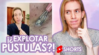 Como NO tratar los granos con pus  Recomendación de un Dermatólogo shorts [upl. by Fabriane]