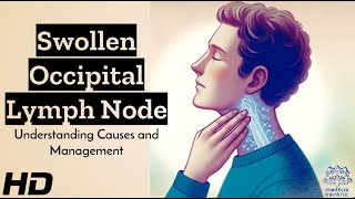 Swollen Occipital Lymph Node Whats Behind It [upl. by Vasti]