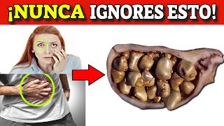 ¡Cuidado Piedras en la Vesícula  Síntomas y Solución de la Litiasis biliar [upl. by Garson681]