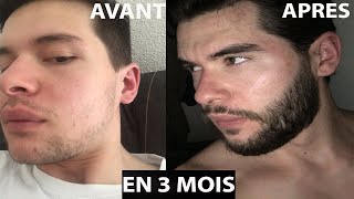 Minoxidil Avant Après Résultat  Comment avoir de la barbe rapidement  Minoxidil Barbe Conflugain [upl. by Raf]