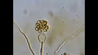 Release of Zoospores by Pythium [upl. by Cammy]