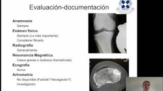 Capsuloligamentosa Rodilla 1 Generalidades y Colaterales 2015 [upl. by Mischa]