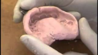 Upper Alginate Impression Evaluation [upl. by Anicul415]