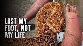 How to Survive The Most Dangerous Snake Bites  Part 3 [upl. by Pliam]