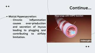 What is COPD its Etiology Pathophysiology Symptoms And Treatment [upl. by Otrebcire]