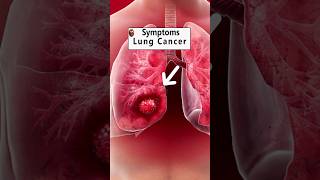 Lung Cancer Symptoms lungs lungcancersymptoms lungcancer [upl. by Yelekreb]