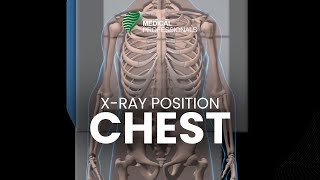 Xray Positioning Chest [upl. by Adnilem946]