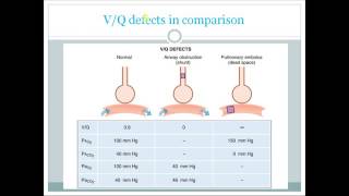 VQ ratio and VQ mismatch USMLE step 1 [upl. by Vassell823]