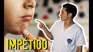 IMPÉTIGO Infección bacteriana en niños👶👦👧 [upl. by Htilil]