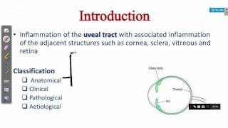 OPHTHALMOLOGY LECTURES diseases of uveal tract UVEITIS [upl. by Arrej391]