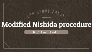 Modified Nishida procedure for 6th nerve palsy [upl. by Leila621]