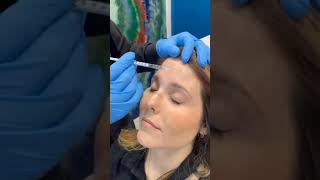 How to lift eyebrows with Botox  Best Eyebrows lift Botox in West Palm Beach Gardens  Dr Dahabra [upl. by Griffie25]