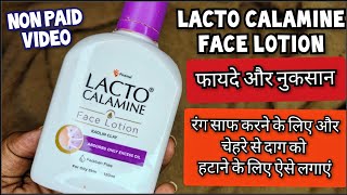 Lacto Calamine Face Lotion लैक्टो कैलामाइन लोशन  How to use lacto calamine lotion Review In Hindi [upl. by Nyhagen763]