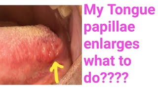 Enlarged tongue papillaeFoliate papillae enlarges whyI have enlarged tongue Papillae what to do [upl. by Ahsikan]