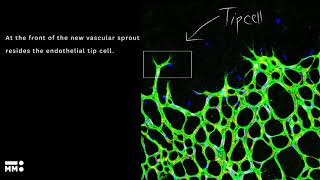 What is angiogenesis [upl. by Jarin]