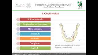 Fracturas mandibulares [upl. by Neala]