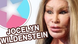 Jocelyn Wildenstein Through The Years in 19 seconds [upl. by Ycnej]