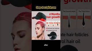 Boost Hair Growth Advanced Laser Cap Technology” HairGrowth LaserTherapy [upl. by Toland275]