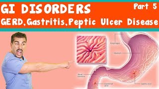 GI Disorders GERD Gastritis peptic ulcer Disease Part 5 [upl. by Akienom]