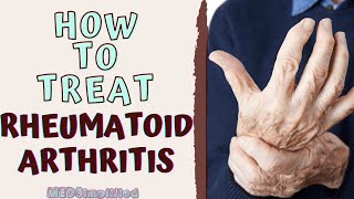 HOW TO TREAT RHEUMATOID ARTHIRITIS RA Signs and Symptoms and Management [upl. by Nhguaval968]