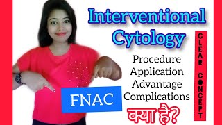 FNAC Fine Needle Aspiration Cytology Interventional Cytology [upl. by Noillid]