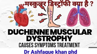 Muscular dystrophy  Homeopathic medicine for muscular dystrophy [upl. by Keyes]