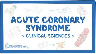 Acute coronary syndrome Clinical sciences [upl. by Azilef184]