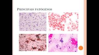 Diagnóstico Laboratorial das infecções bacterianas do sistema nervoso central [upl. by Crissie]