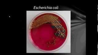 Bacteriology Gram Negative Bacilli Part1 [upl. by Tnomel]