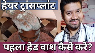 Hair Transplant के बाद पहला Head wash कैसे करे Hindi  How to Wash head after Hair Transplant [upl. by Albers395]