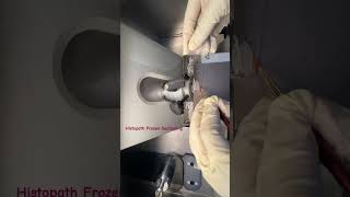 histopathology  epithelialtissue histopathology machine tissueculture patho frozensection [upl. by Ardnua887]