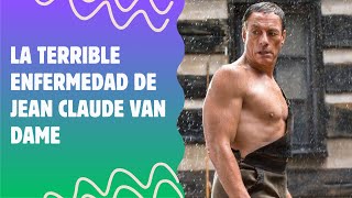 La terrible enfermedad de jean claude van dame [upl. by Neerihs573]