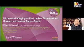 US Imaging of the Lumbar Paravertebral Region and Injection Techniques Dr MK Karmakar Hong Kong [upl. by Enilrac]