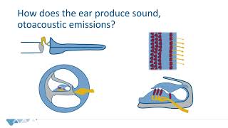 Otoacoustic emissions OAE  Introduction for newborn hearing screening programs [upl. by Hussar]