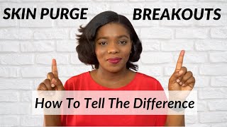 How To Tell If Your Skin is Purging Or Breaking Out  Skin Purge Vs Breakouts  Dr Janet [upl. by Jacobsen529]