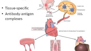 Hypersensitivity amp autoimmune diseases PART 1of2 Recorded Lecture [upl. by Even489]