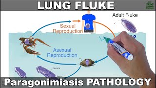 Paragonimiasis  Lung fluke and its Life Cycle [upl. by Enymzaj963]