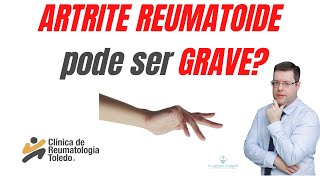 Existem formas GRAVES de ARTRITE REUMATOIDE [upl. by Xxam]