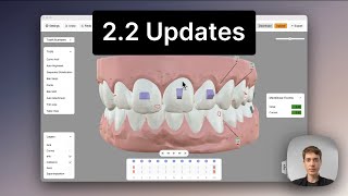 ArchForm 22 Updates [upl. by Kcinimod342]