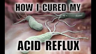 How I cured my Acid Reflux and Helicobacter Pylori infection without antibiotics [upl. by Pheni]