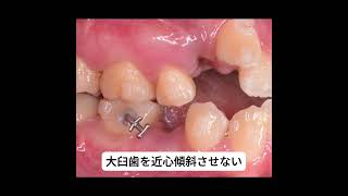 KOTSU HOOK動画 [upl. by Mick]