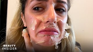 What It’s Like To Get A Chemical Peel For Acne Scars  Beauty Explorers  Beauty Insider [upl. by Nivrac278]