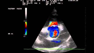 Herzultraschall Aortenklappeninsuffizienz beim Pferd [upl. by Heringer24]
