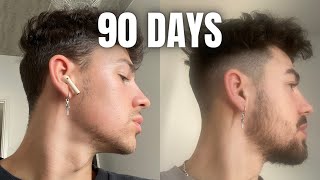 How To GROW A BEARD In 90 Days Using MINOXIDIL amp DERMA ROLLER [upl. by Blackington]