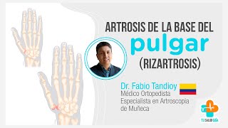 ARTROSIS de la base del pulgar Rizartrosis  Tu Salud Guía [upl. by Nadabb186]