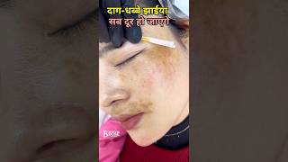 MULTANI MITTI PACK  Get Fair amp Glowing Skin At Home shorts Beautykadose [upl. by Amor]