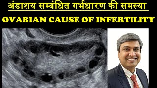 अंडाशय सम्बंधित गर्भधारण की समस्या  OVARIAN CAUSE OF INFERTILITY [upl. by Ellerrehs]