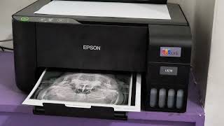 EPSON Printer at Work Head Xray Printout [upl. by Ranjiv]