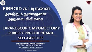 Fibroid கட்டிகள் இருந்தாலும் கருத்தரிக்க முடியுமா Laparoscopic Myomectomy Surgery [upl. by Flin]